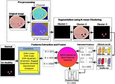 An optimized features selection approach based on Manta Ray Foraging Optimization (MRFO) method for parasite malaria classification